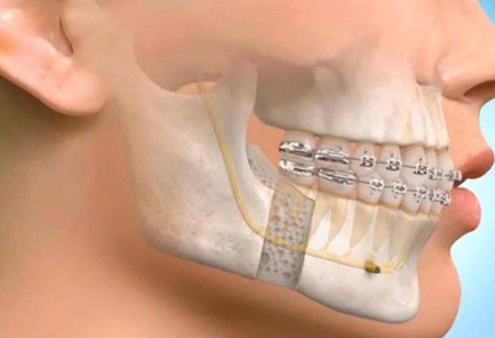 Dental and Facial Trauma Management