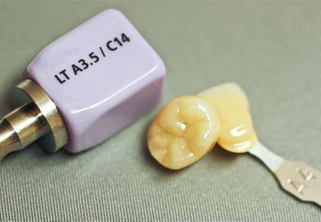 Lithium Disilicate